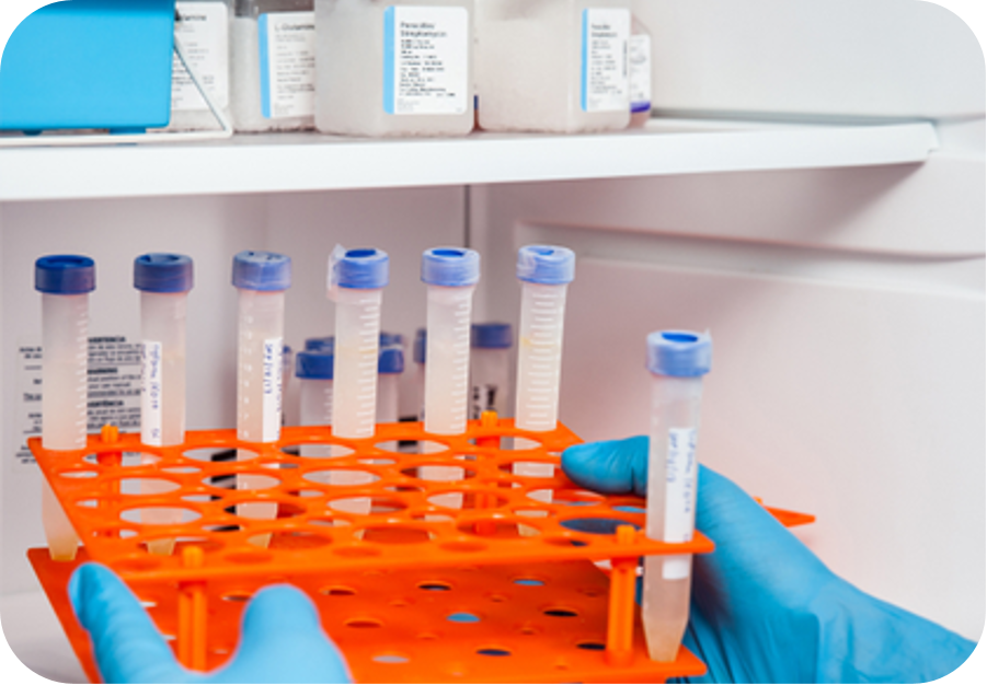 Glossy Silver BOPP Film